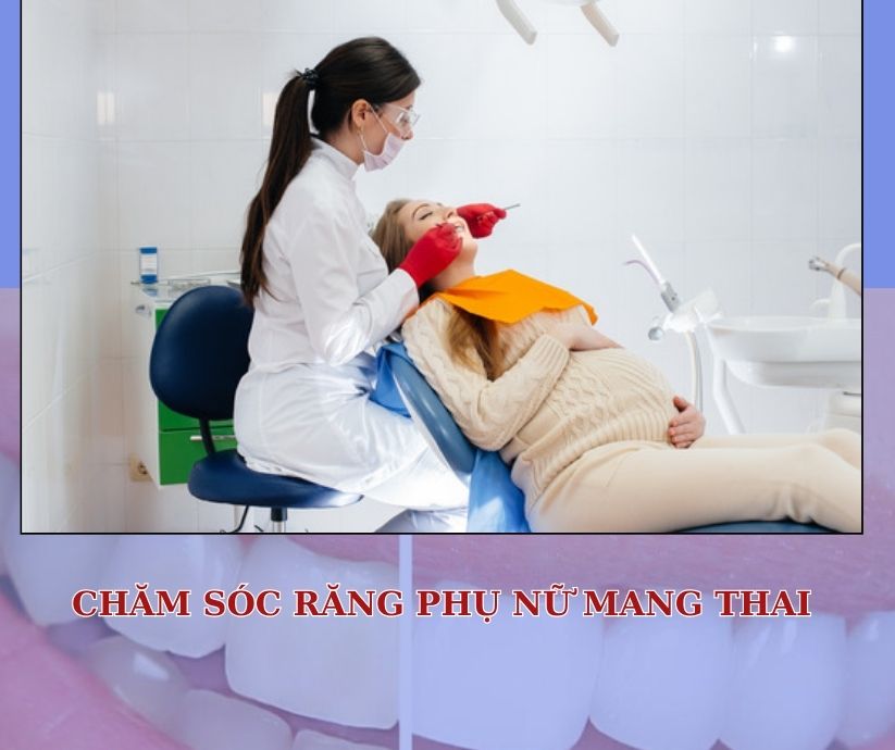 CẠO VÔI RĂNG PHỤ NỮ MANG THAI